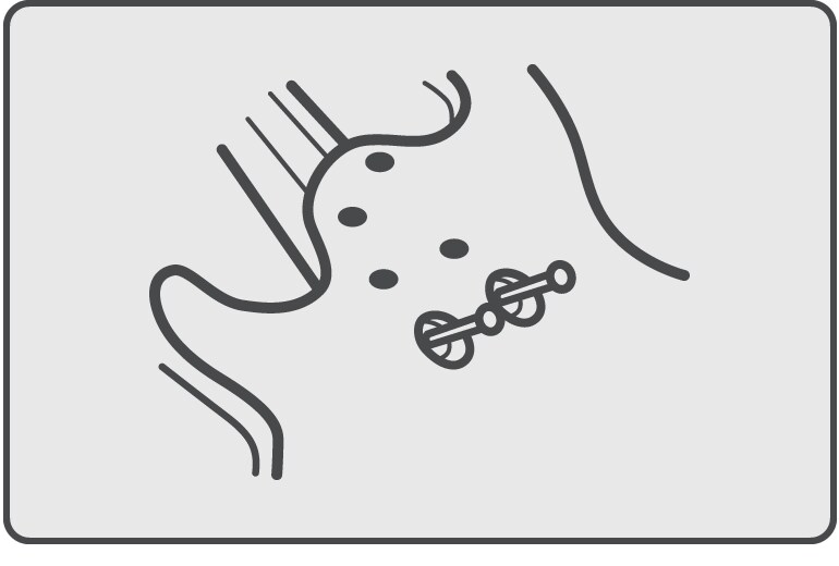 Sistema de fixação angular